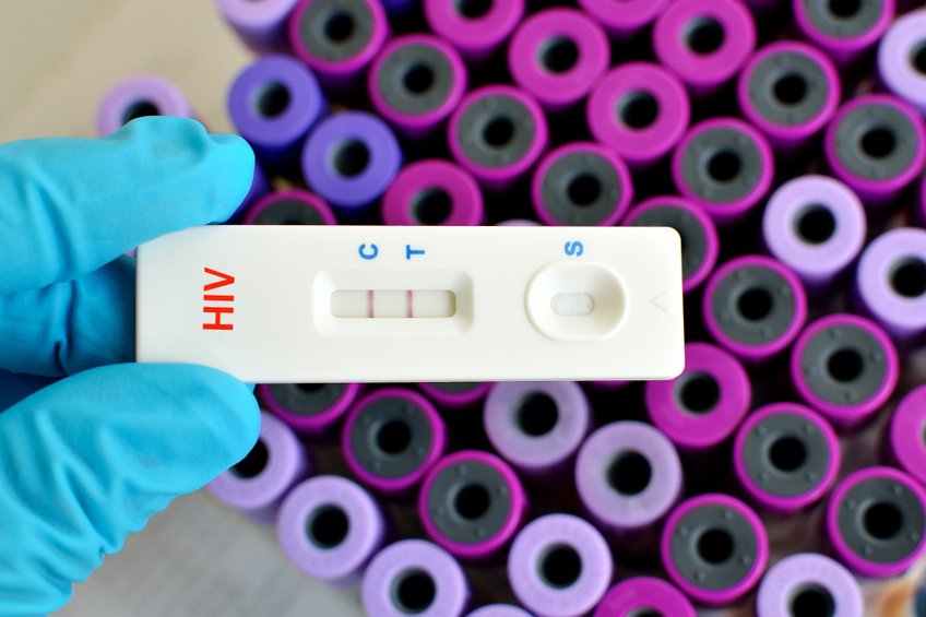 early stage hiv symptoms rash, arlington hiv screening test
